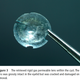 Illustration for article titled 28 Years After Woman 'Loses' Contact Lens, Surgeons Find It Embedded in Her Eyelid